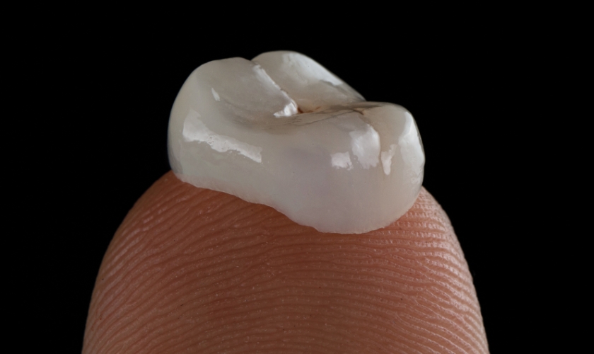 Dental Crown in Richardson