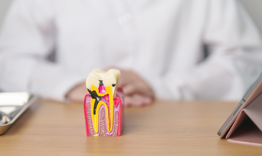 root canal aftercare tips